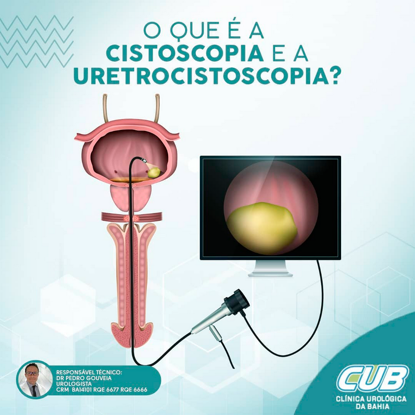 Cub Clínica Urológica Da Bahia Urologista Em Salvador A Clinica