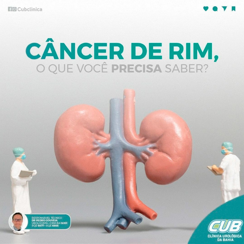 Câncer De Rim O Que Você Precisa Saber Cub Clínica Urológica Da