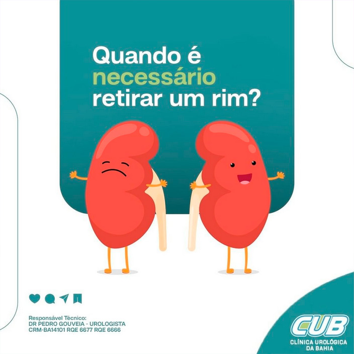 Quando é Necessário Retirar Um Rim Cub Clínica Urológica Da Bahia